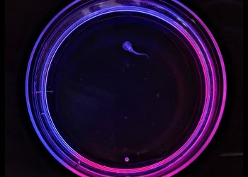 Alzheimer’s drug may save lives through ‘suspended animation’