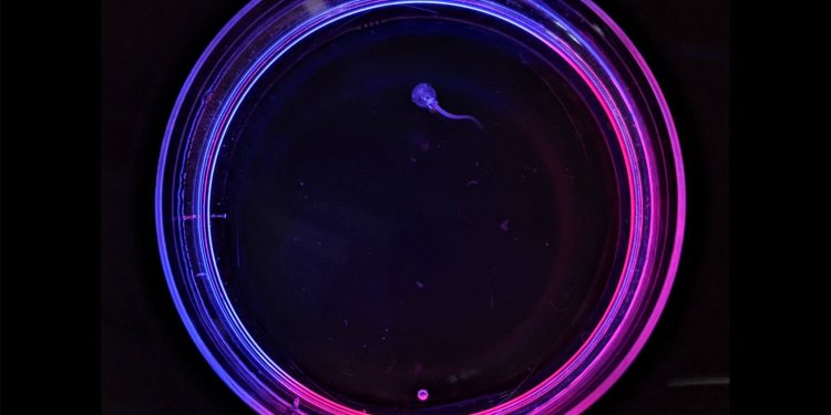 Alzheimer’s drug may save lives through ‘suspended animation’