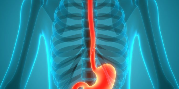 Parkinson’s may take a ‘gut-first’ path