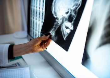 A setback to research that offered hope for fibrous dysplasia patients