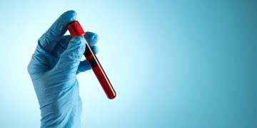 Blood test has potential to detect earliest signals of Alzheimer’s disease