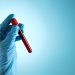 Blood test has potential to detect earliest signals of Alzheimer’s disease